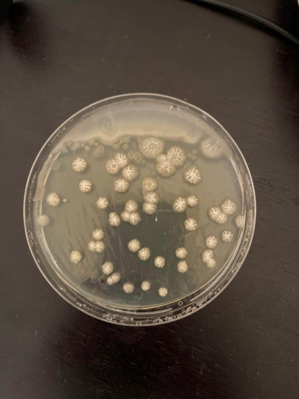 petri dish bacteria after three days not washing hair