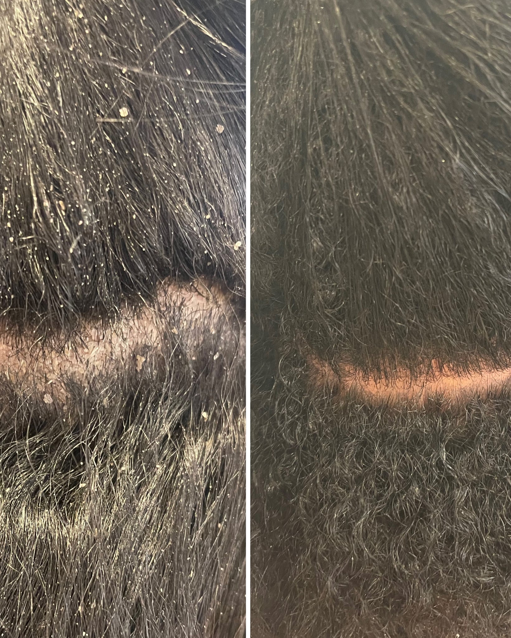 Pre-Scalp Cleanser