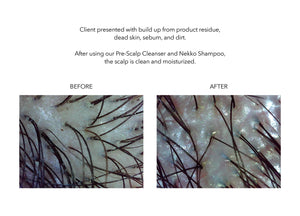 Nekko pre cleanser case study scalp treatment before and after