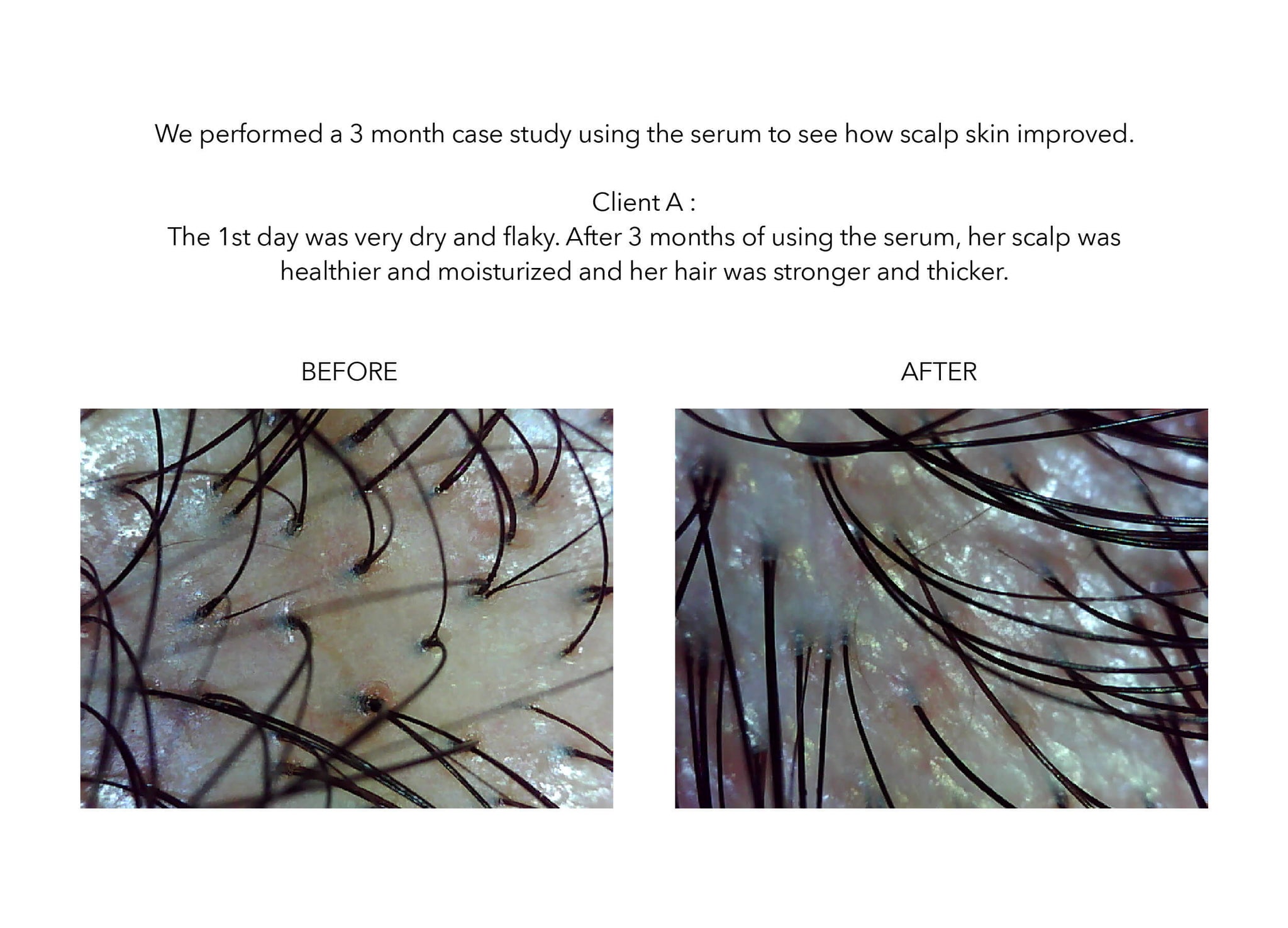 Nekko rejuvenation serum scalp treatment before and after
